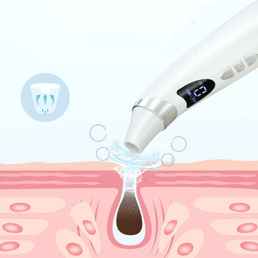 Electric Visual Blackhead Suction For Skin